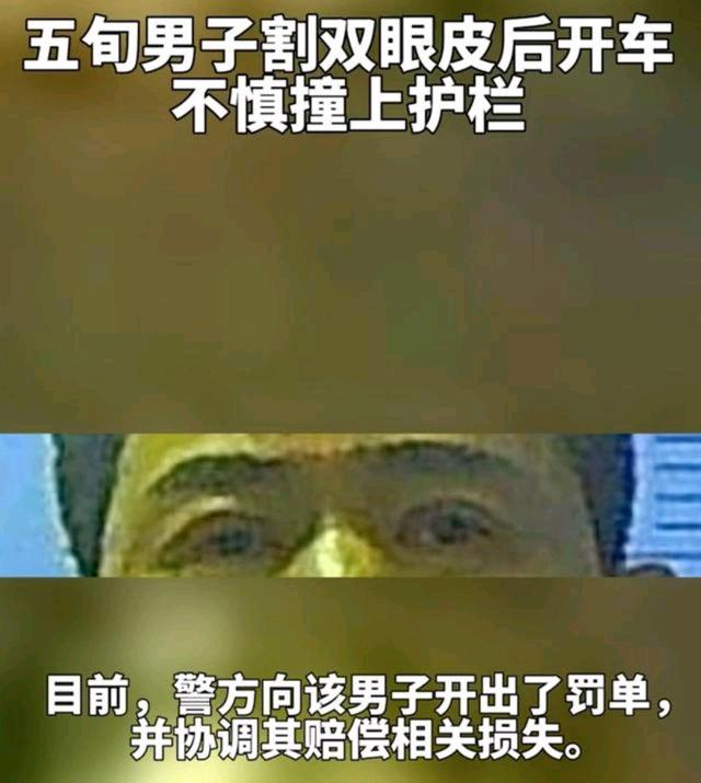 臭美的五旬男子因刚割双眼皮开车撞上护栏.宝马也要坏了